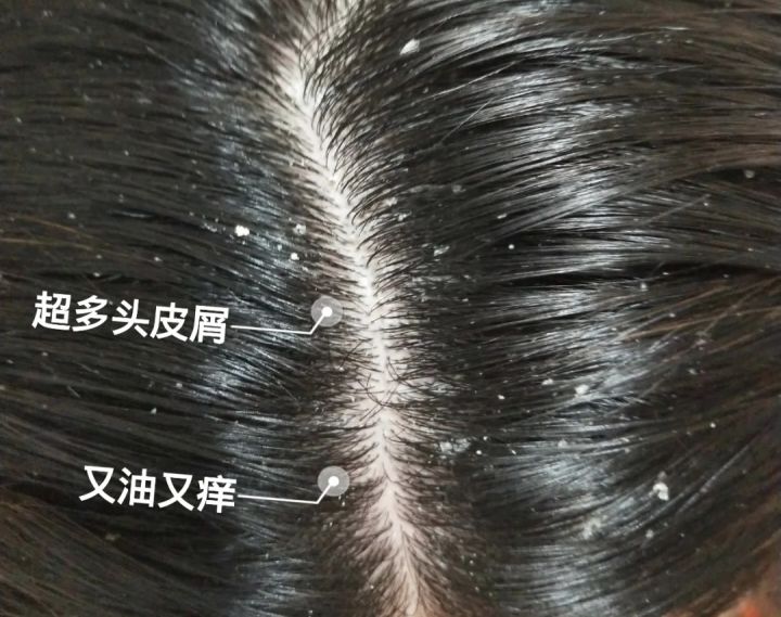 适合孕妇的免洗洗发水,孕期用的温和洗发水推荐