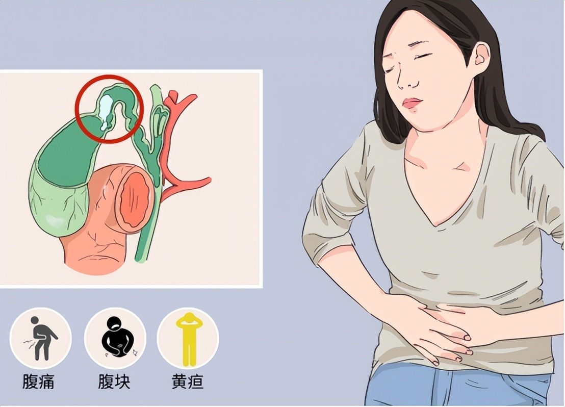 急性胆囊炎的主要治疗方法有哪些,急性胆囊炎最佳的治疗方案是什么