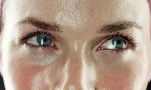 脸上很油是好还是坏,脸上感觉油但是起皮