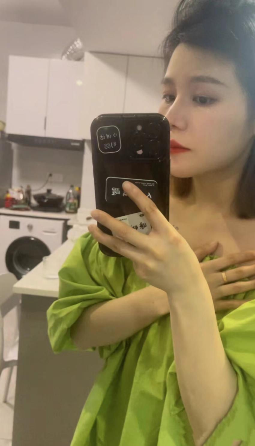 猪鼻整形手术,鼻头肥大鼻子整形成功案例