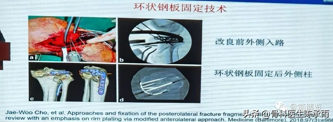 国家卫健委主办的骨创伤专项能力培训项目----下肢损伤学习班