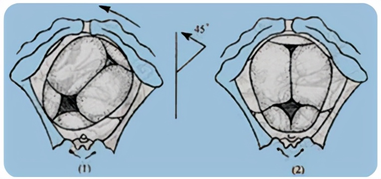 胎儿屁股在右侧是什么胎位,胎位roa屁股在左边还是右边
