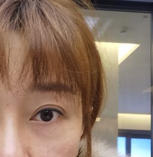 近距离感受五官,双眼皮深肉条凹陷图片