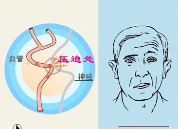 左眼跳财右眼跳灾眼皮总跳是啥病,左眼跳财右眼跳灾身体出现了问题