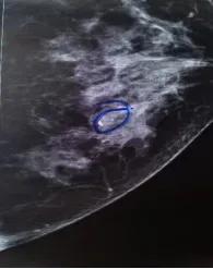 42岁女性体检应该检查哪些,45岁的女人体检项目