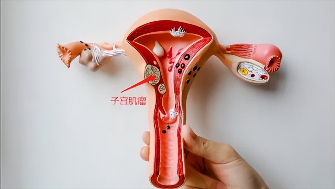 绝经后切除子宫对身体有什么影响,子宫脱垂切除子宫对身体有影响吗