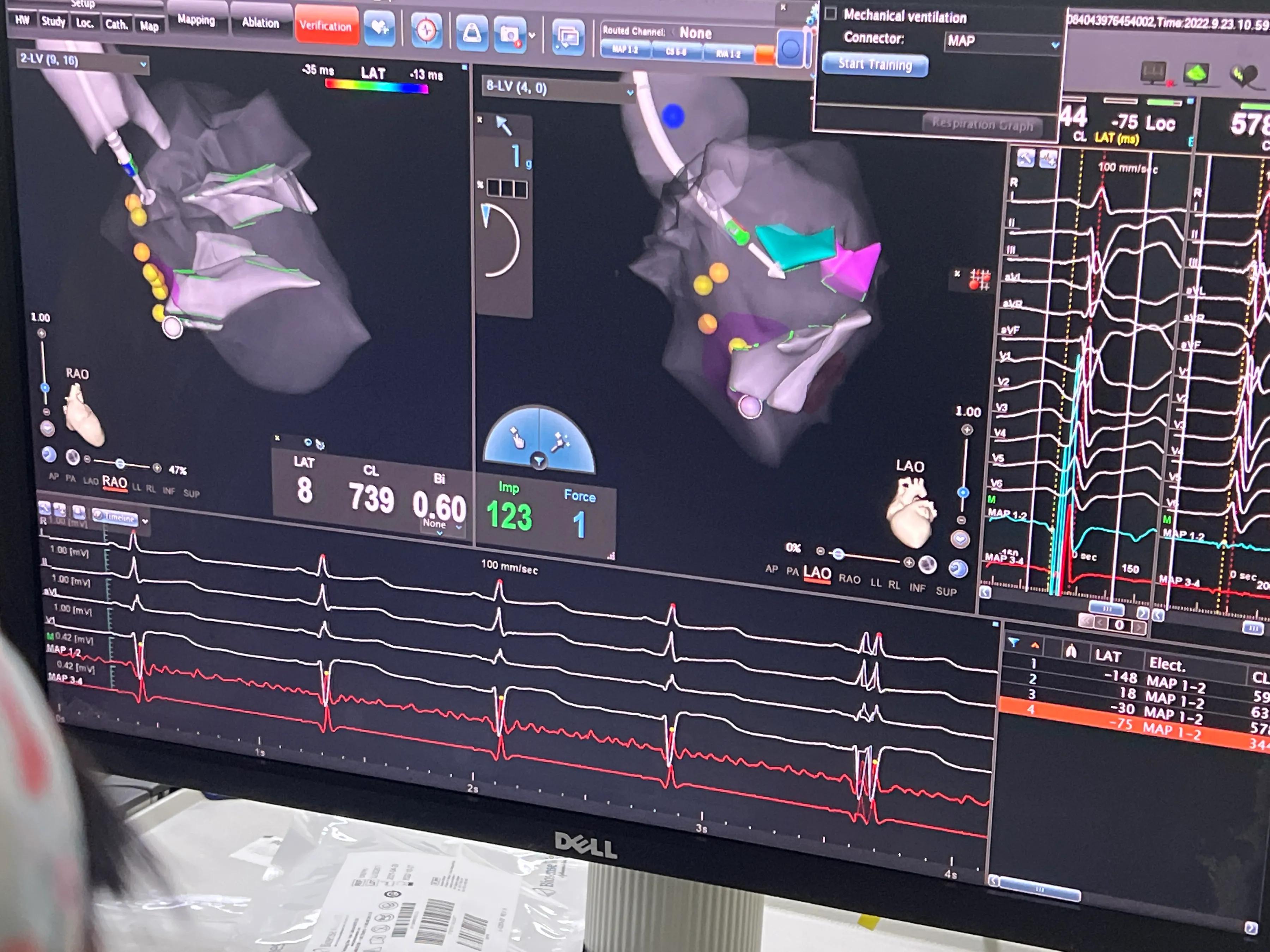 胸闷气促病例分析,小孩胸闷气短去检查说有炎症