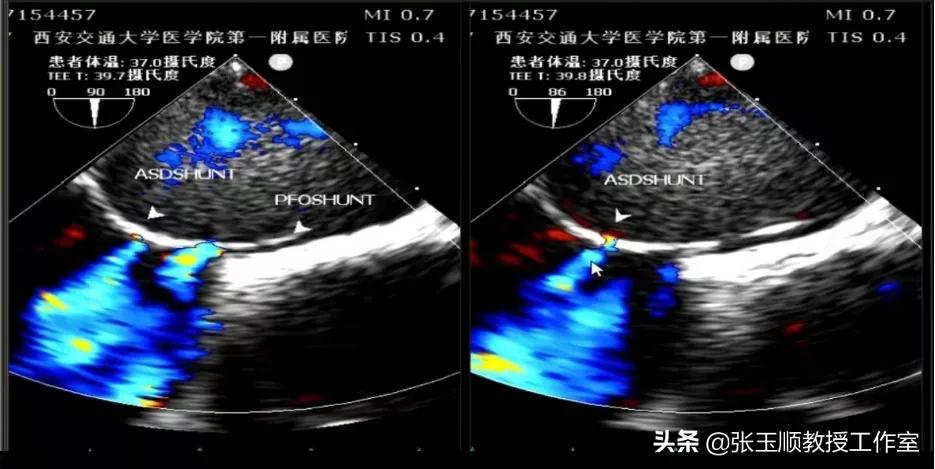 咳嗽不停该咋办导致晕厥,反复咳嗽一个月了是什么原因