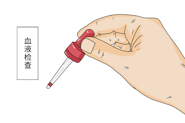 元宝鸽蛋和普通鸽子蛋有什么区别,鸽子蛋和鸡蛋价格差很多吗