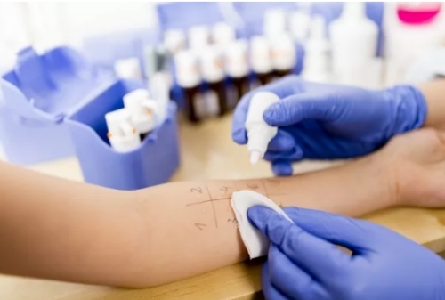 哪些过敏源会引起皮肤过敏,皮肤过敏吃几天过敏药可以好