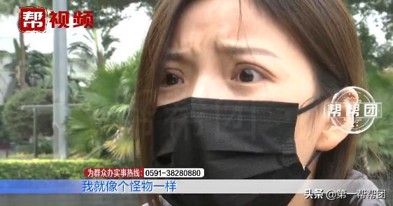 90后割双眼皮亲身经历,割了双眼皮后特后悔