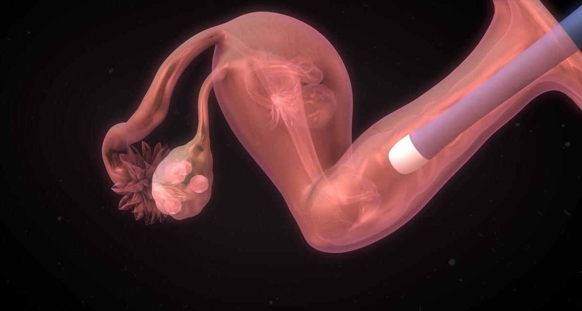 试管婴儿生的是不是聪明,试管技术出生的宝宝健康吗