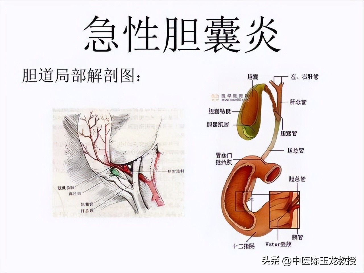 胆囊炎胆囊息肉胆结石中医偏方,胆囊炎胆结石胆囊息肉吃什么药好