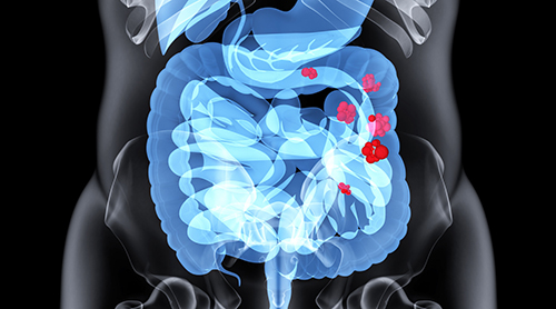 胃肠道b超可以检查出什么,4岁小孩子胃肠道检查查什么