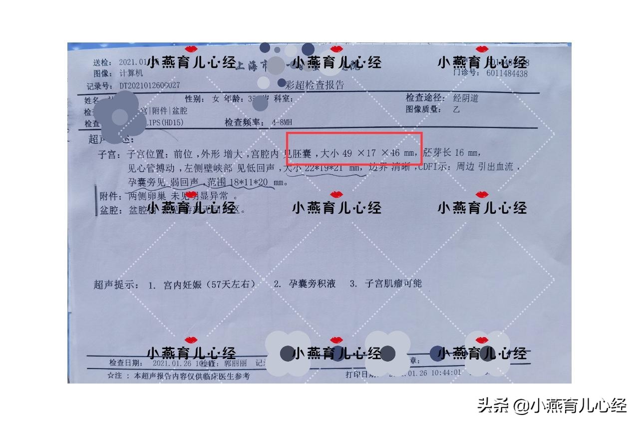 从多囊卵巢囊肿患者到成为二胎妈妈，我是如何养成易孕体质
