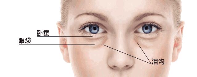 只需知道一招轻松消除显老泪沟,用什么办法能让泪沟修复