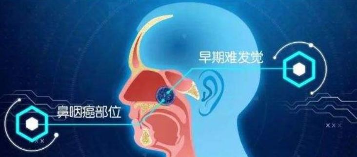 鼻咽癌是怎样放疗的,有什么方法治愈鼻咽癌的