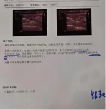 42岁女性体检应该检查哪些,45岁的女人体检项目