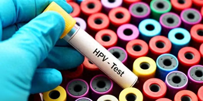 全球最美女人之一去世，仅26岁！曾在中国参加选美比赛，外网悼念