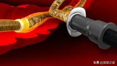 这七大肿瘤筛查方法请牢记，以防被不良体检中心忽悠！