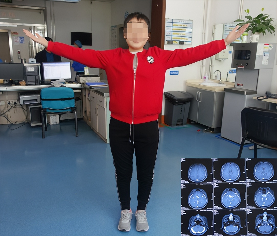 结核性脑积水能治愈吗,儿童结核脑膜炎脑积水