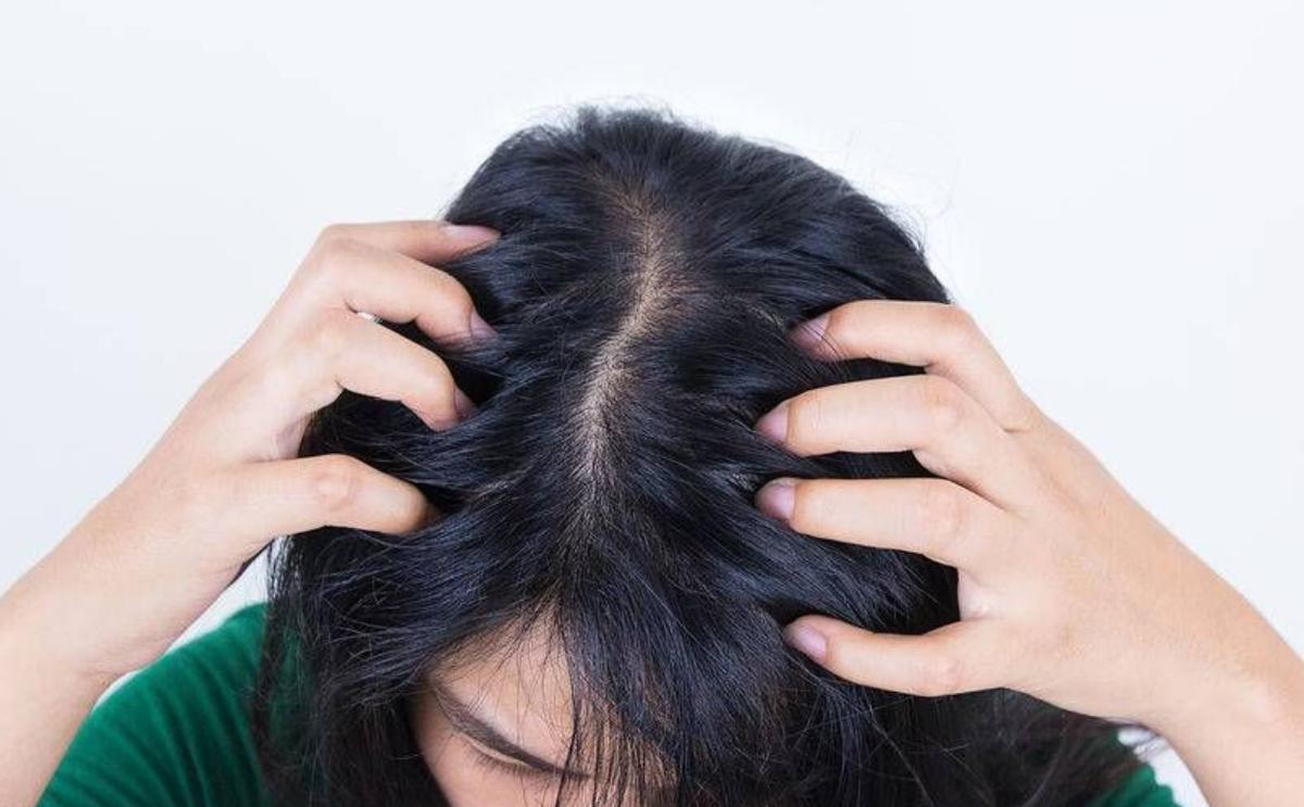 头皮里总是长疙瘩和脓包怎样治疗,头皮总长疙瘩和脓包是怎么回事