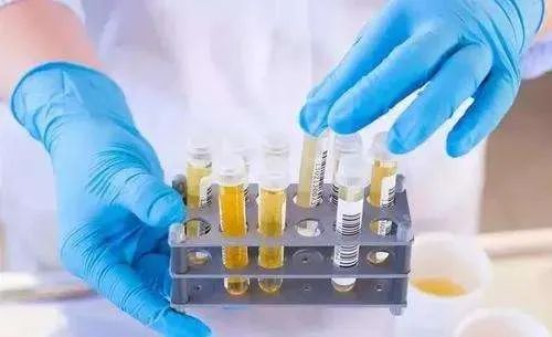 为什么一体检一住院,护士小姐姐就催你留尿尿?