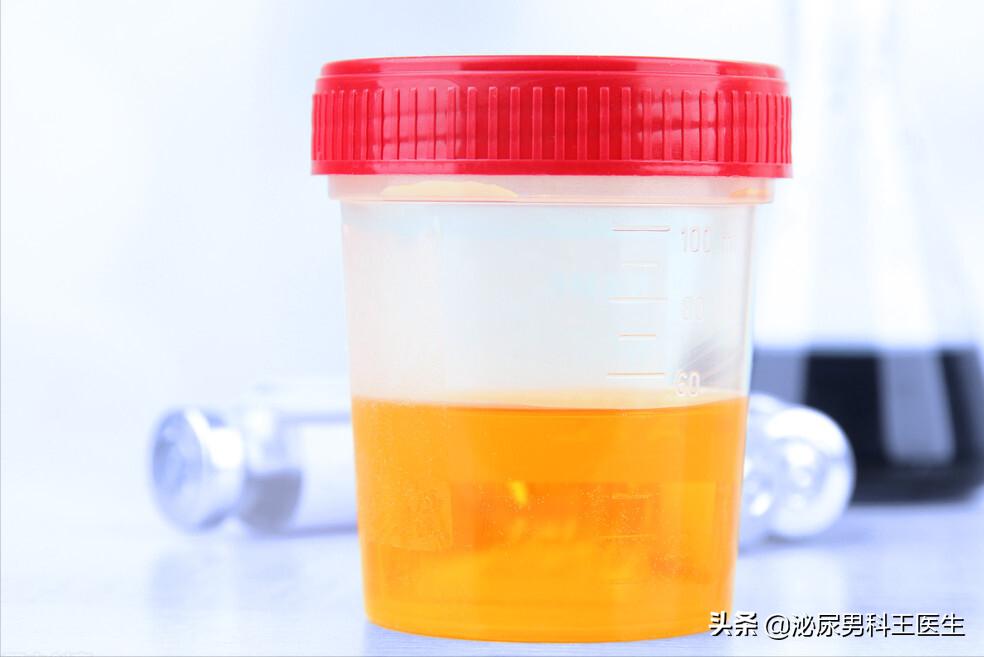 尿酸过高怎么能快速排出尿酸,尿酸高如何排出