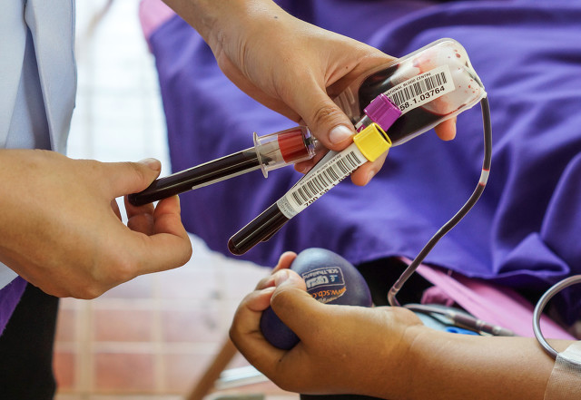 三岁孩子手脚心发黄是怎么回事,7岁女孩手心脚心发黄是什么原因