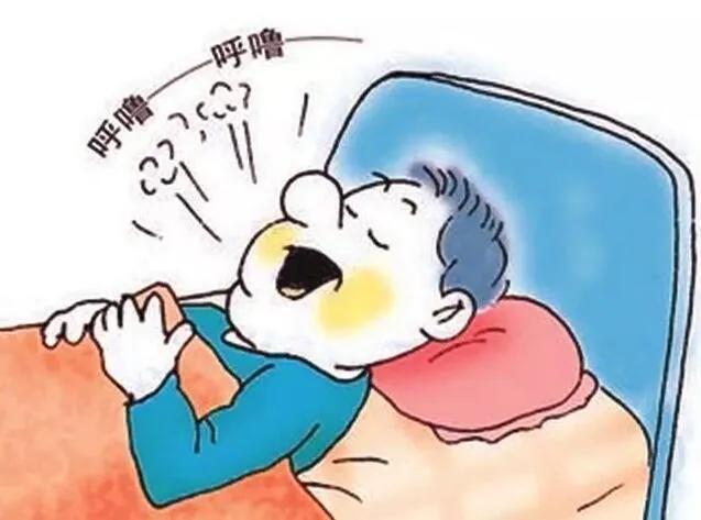 中枢性打鼾诊断,打鼾综合症怎么治疗最好