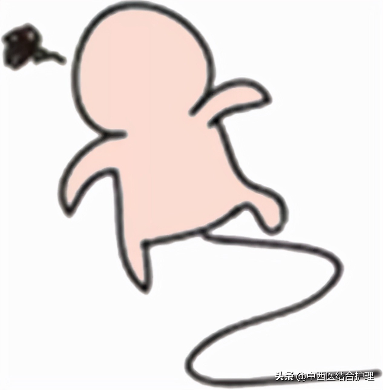 「脑梗病科普」一个周末8个脑梗，他们都有一共同特点！​神药安宫牛黄丸到底能不能救命？