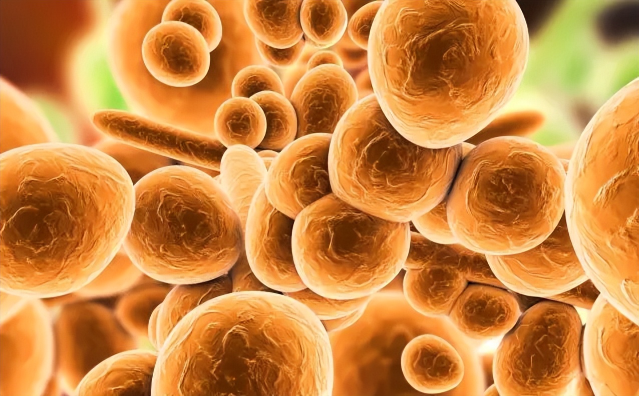 念珠菌真菌感染会引起尿频尿急吗,念珠菌真菌是什么