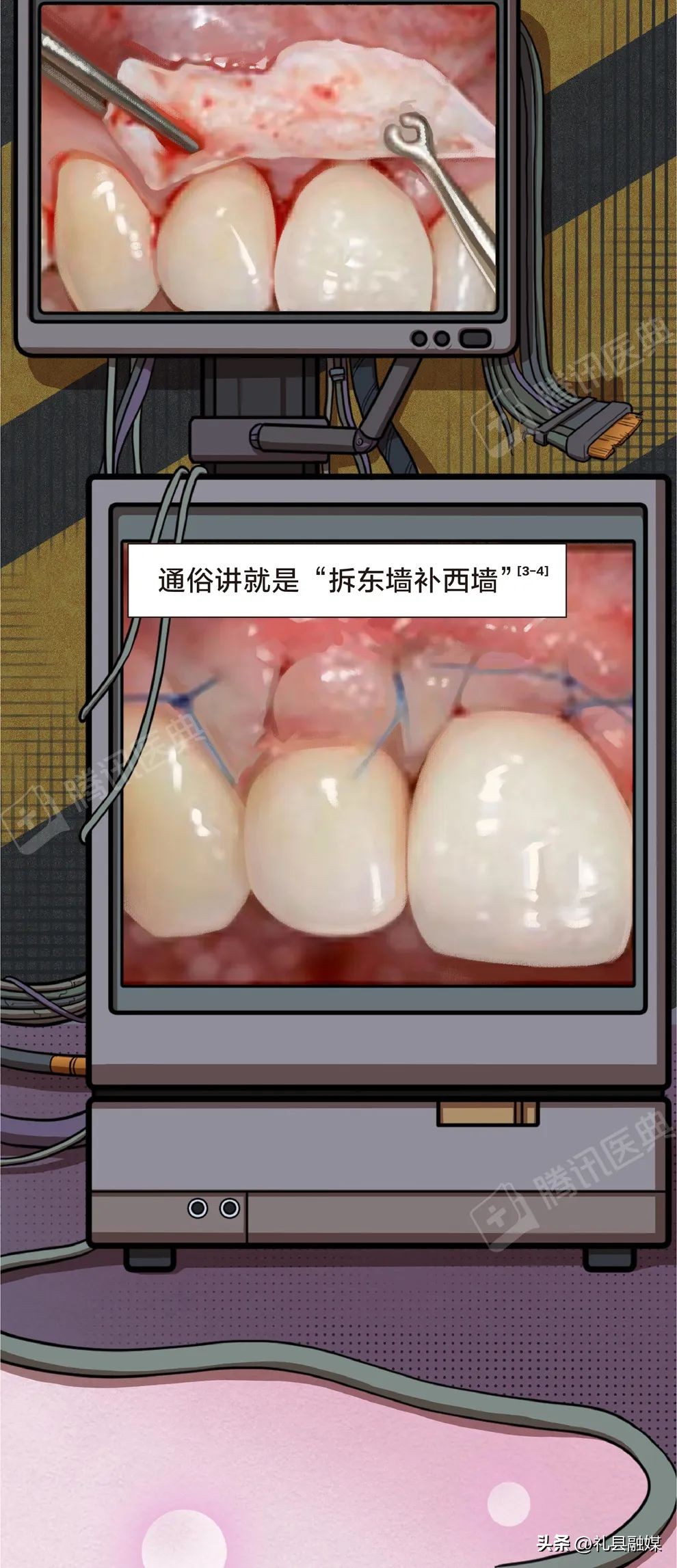 牙缝隙大吃菜就塞牙怎么修复,牙齿吃菜老塞牙怎么办