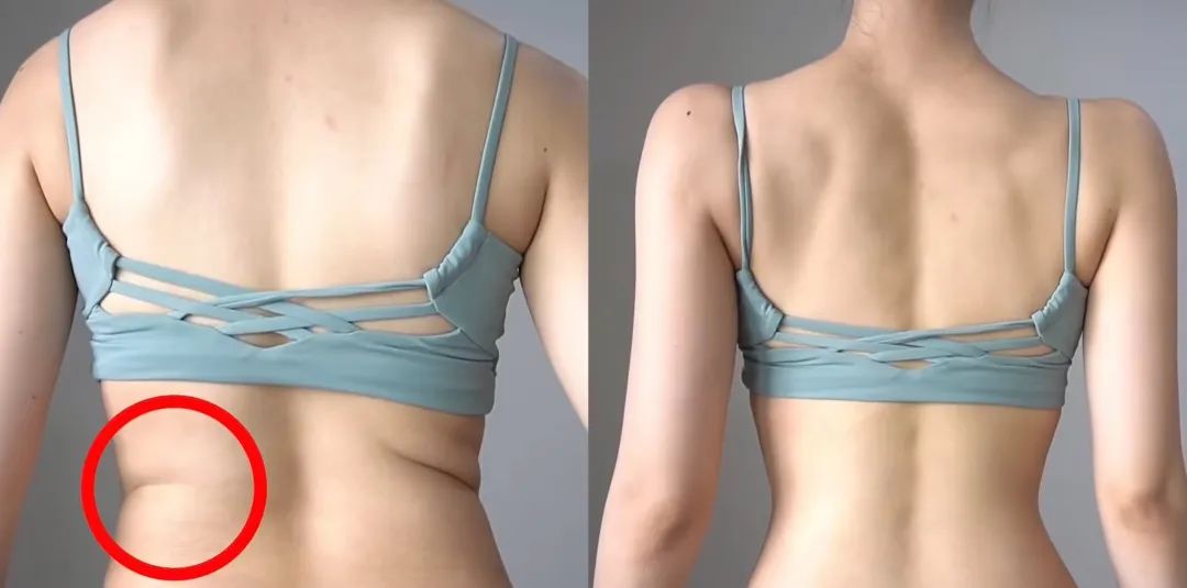 看起来胖实际没多重,胖有可能也是营养不良图文