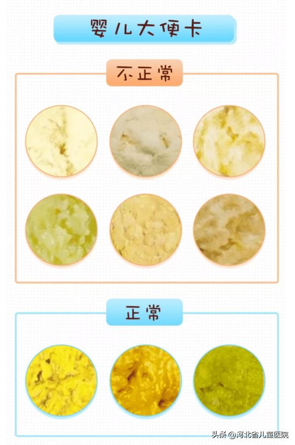 婴儿的黄色便便放一段时间变白,宝宝便便颜色白怎么回事