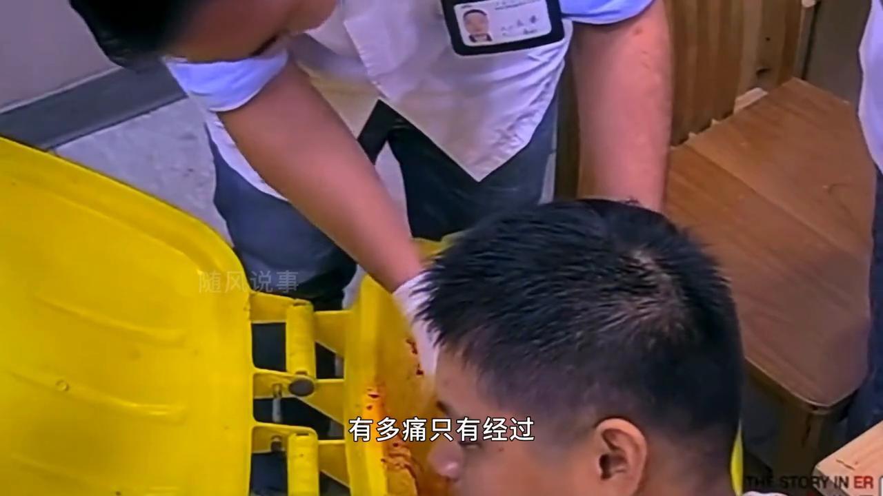 男子手指被压断淡定走路去医院,手掌被压了一个小时