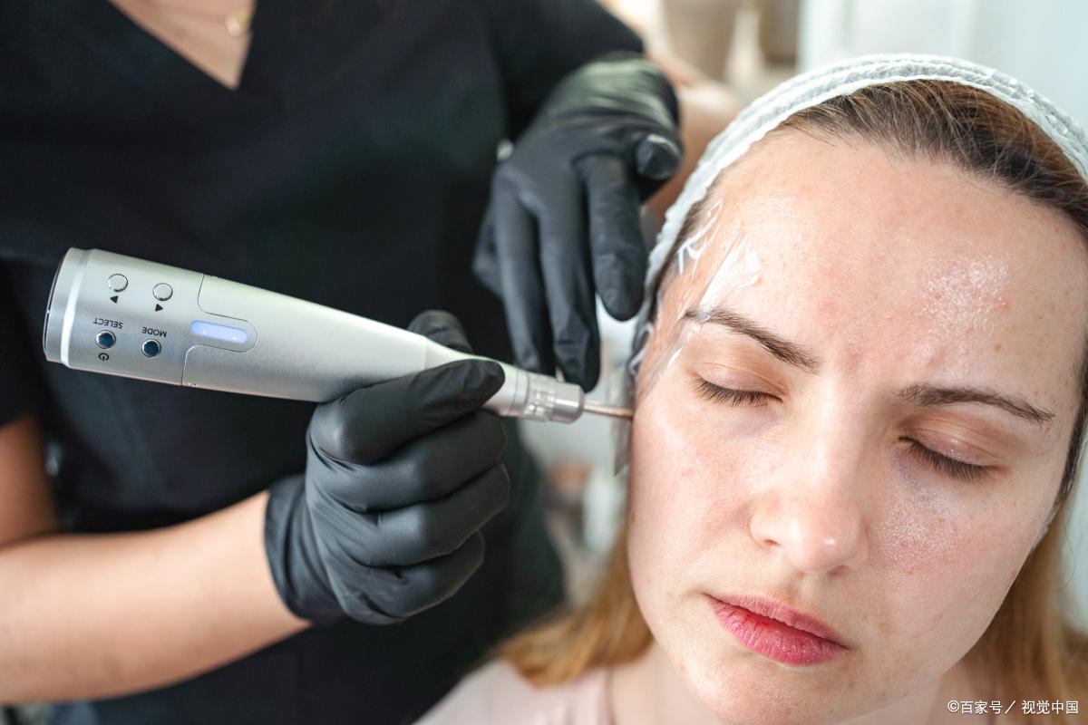 自己怎么改善毛孔粗大缩小毛孔,有痘痘毛孔粗大怎样缩小毛孔