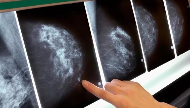 央视新闻衣服致癌物超标,衣服致癌物超标有哪些