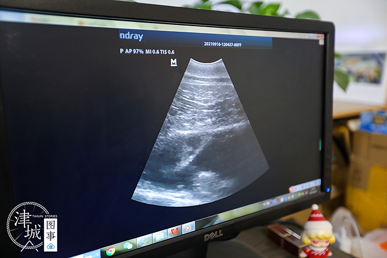 「津城图事」两个月颜值逆袭爹妈，天津这位“混血王子”可真好看