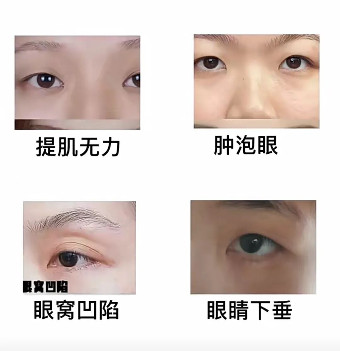 疲惫脸色不好怎么办,疲惫脸补救