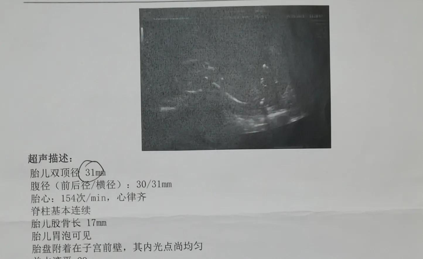 当事业上升期遇到怀孕该怎么选择,当事业遇到瓶颈期就想结婚