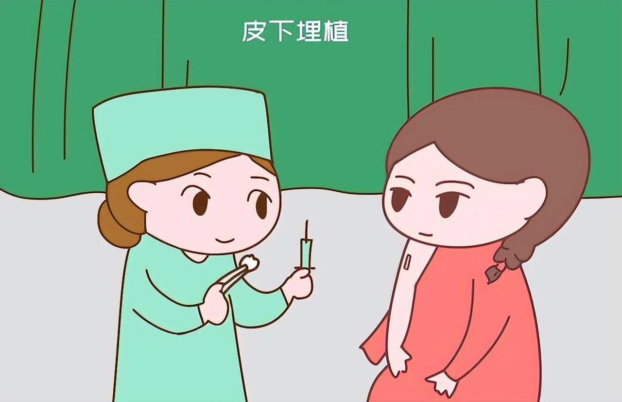 节育环不取出，会长到肉里吗？医生提醒：最佳取环年龄别超这个数