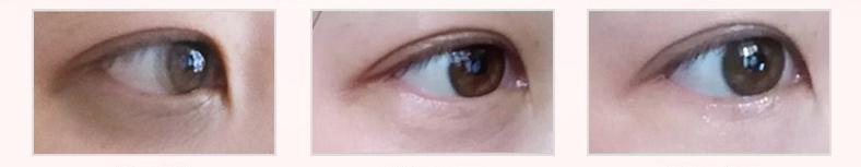 教你眼部紧致淡纹,如何通过护肤改善眼周纹