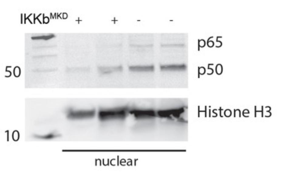 核因子,NFκB,在临床治疗上,是否与腱切断术的肌肉萎缩无关?