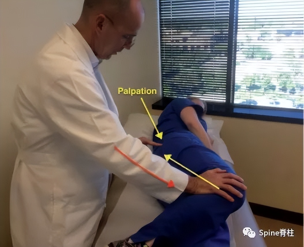 腰椎间盘突出下肢放射痛严重吗,下肢放射疼痛是间断性严重吗