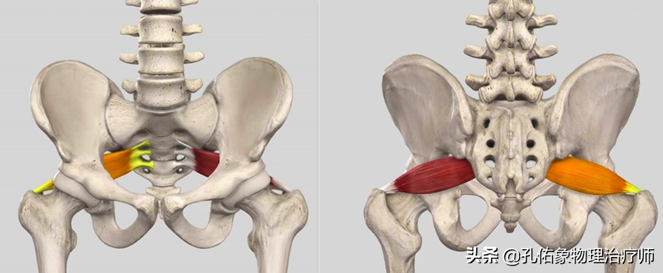导致坐骨神经痛的原因是什么,坐骨神经痛有些反复什么原因
