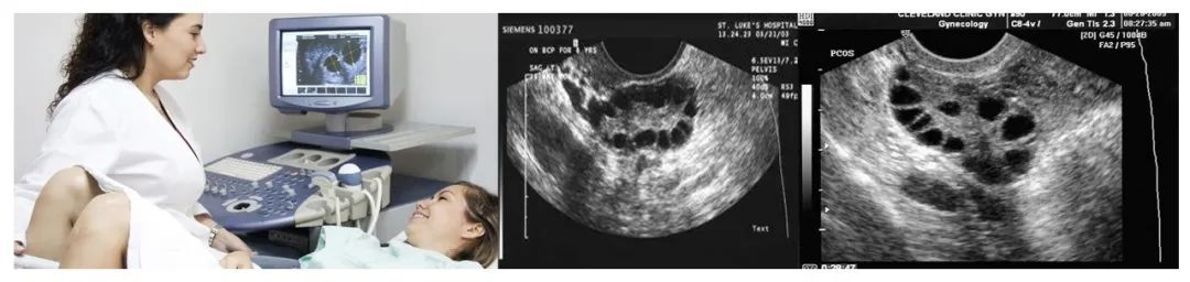 卵巢和年龄的关系,你的卵巢