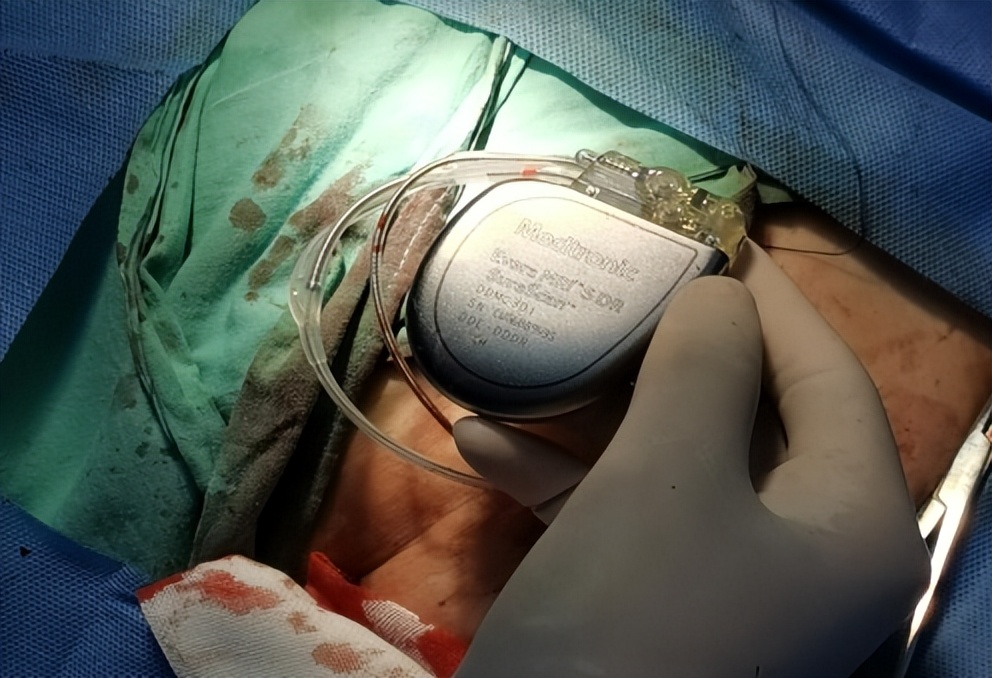 鍝堝皵婊ㄥ尰澶т竴鍖婚櫌椤剁骇鎵嬫湳,鍏ㄥ浗棣栦緥澶у瀷鎵嬫湳鐜板満