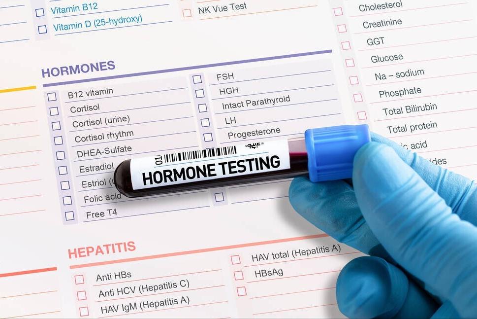 看不懂性激素六项检查报告单,性激素六项结果医生有没有不懂的