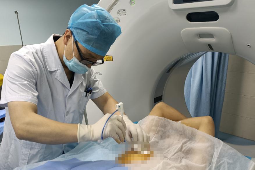 消融术治疗13mm肺结节,肺结节微创手术伤口部分不愈合